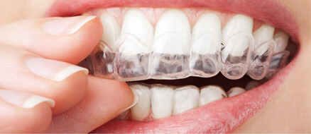 Invisalign Advanced Orthodontics